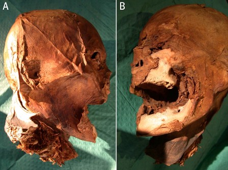 мумифицированная голова Генриха IV